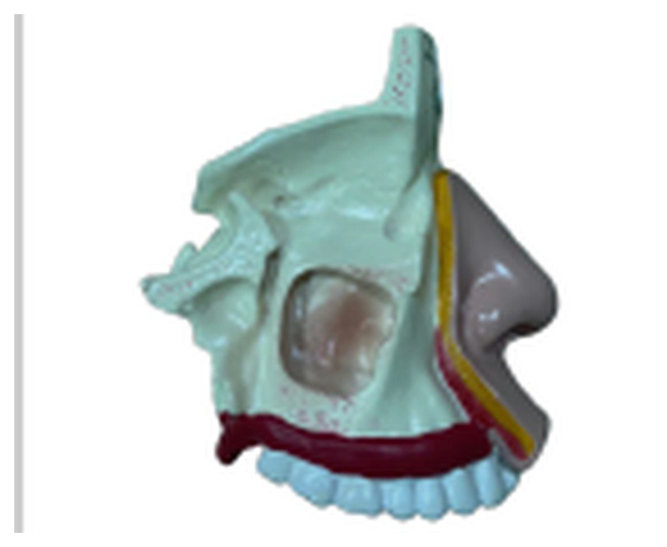 Modelo de Nariz com Arcada Dentária Superior